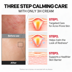 medicube - 3H Relief Cream | Crema facial 50 ml