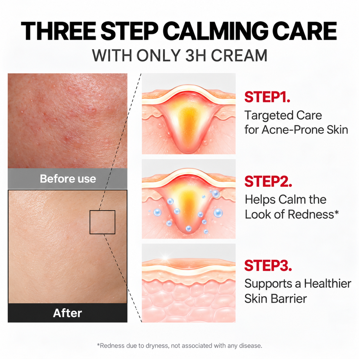medicube - 3H Relief Cream | Crema facial 50 ml
