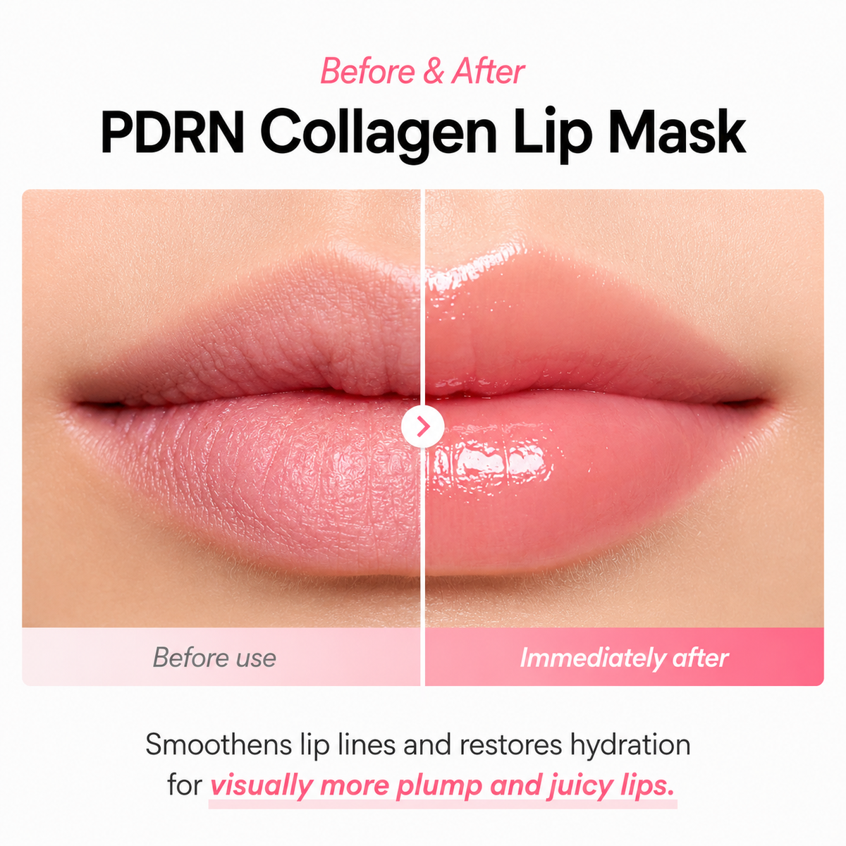 Abib PDRN Collagen Lip Mask Glazed Jelly | Mascarilla para labios 11 g